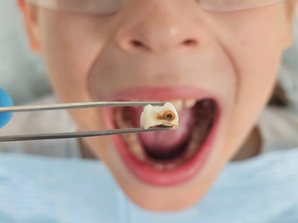 Best Emergency Treatment for Oral Infections in Sand Lake, MI
