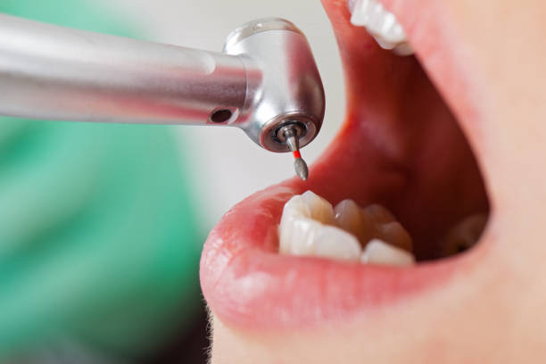 Best Dental Abscess Treatment in Sand Lake, MI